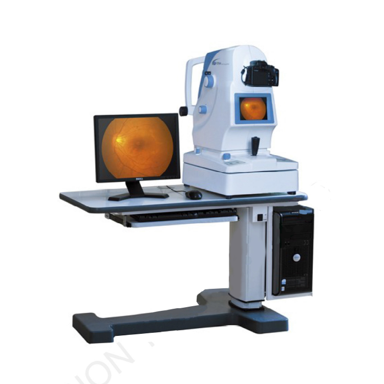 六六视觉 免散瞳眼底照相机 MK-YZ50A 六六视觉 免散瞳眼底照相机 MK-YZ50A